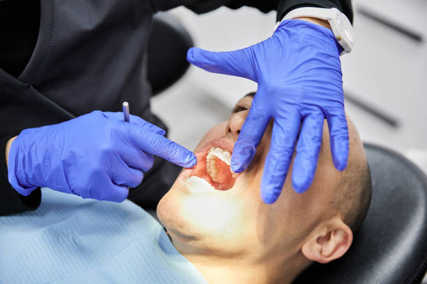 Best Emergency Dental Care for Sports Injuries in Northampton, PA